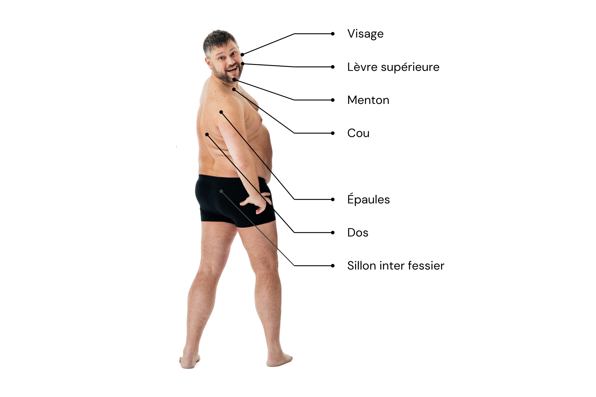 Épilation définitive au laser à Joliette Médico-Esthétique 360