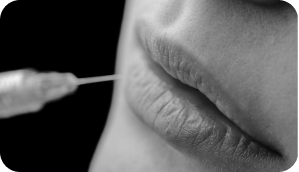 Agents de comblement - Fillers Agents de comblement - Fillers